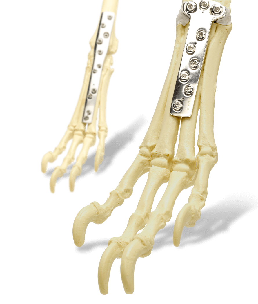 Carpal Arthodesis